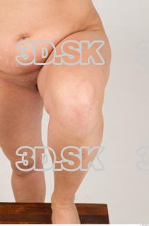 Knee texture of Pat 0001